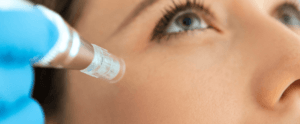What is Microneedling? G+T Stamford Aesthetics